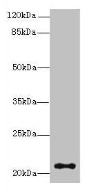 JAGN1 Antibody