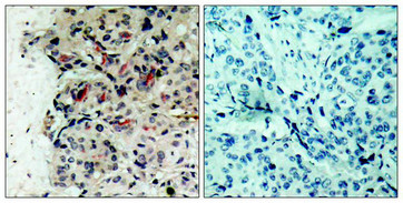 JAK1 (Ab-1022) Antibody