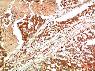 JAK1 Antibody