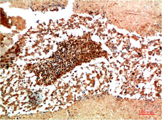 JAK1 antibody