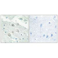 JAK1 antibody