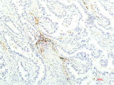 JAK1 antibody