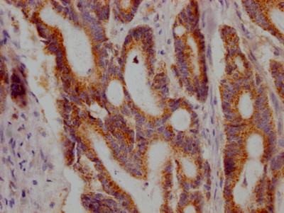 JAK1 Recombinant Monoclonal Antibody