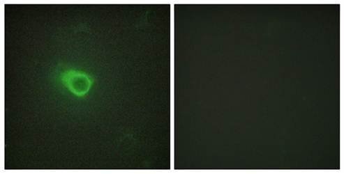 JAK1 Antibody