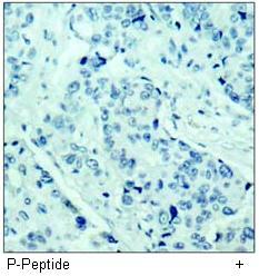 JAK1 (Phospho-Tyr1022) Antibody