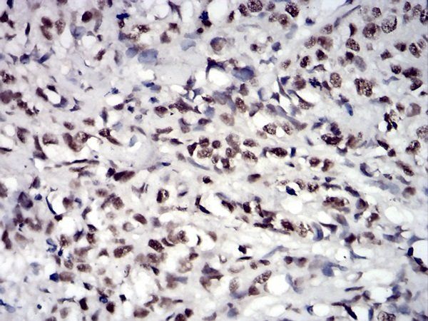 JAK2 Antibody