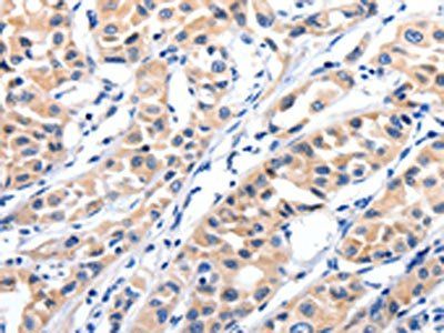JAK2 Antibody