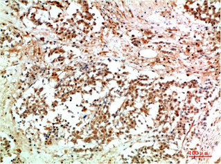 JAK2 Antibody