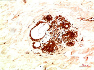 JAK2 Antibody