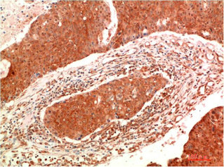 JAK2 Antibody