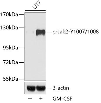 Jak2 (Phospho-Y1007/1008) antibody