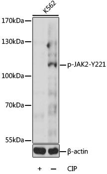 JAK2 (Phospho-Y221) antibody
