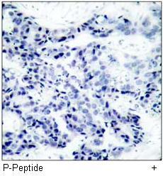 JAK2 (Phospho-Tyr1007) Antibody