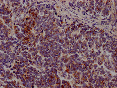 JAK3 Antibody