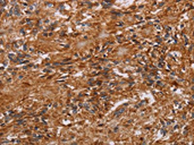 JAKMIP2 Antibody