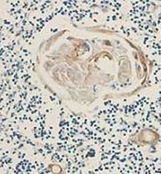JAW1 Rabbit Polyclonal Antibody