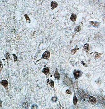 JHDM1D Rabbit Polyclonal Antibody
