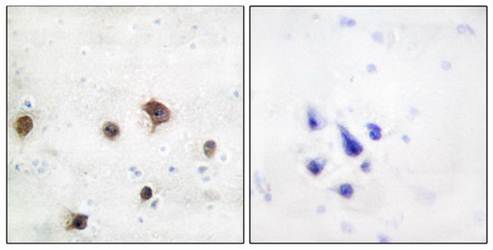 JIP2 antibody