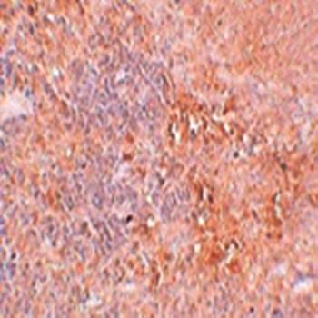 JMJD4 Antibody