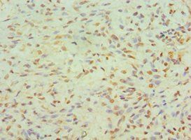 JMJD6 antibody