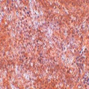 JMJD8 Antibody