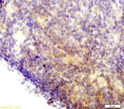 JNK1/2/3 (phospho-Thr183/185) antibody