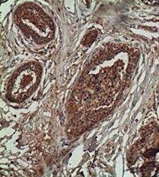 JNK1 Rabbit Polyclonal Antibody