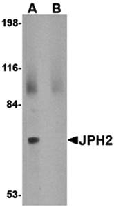 JPH2 Rabbit Polyclonal Antibody