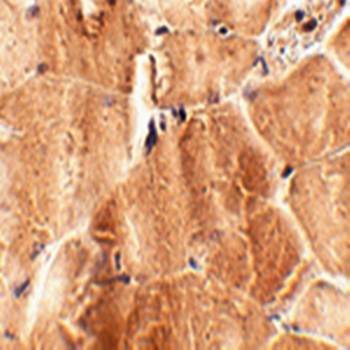 JPH2 Antibody