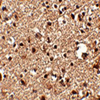 JPH4 Antibody