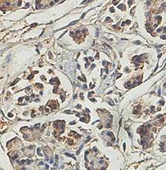JTB Rabbit Polyclonal Antibody
