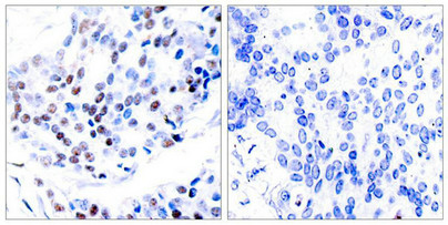 JUN Antibody