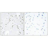 JUN Antibody