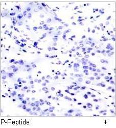 JunB (Phospho-Ser259) Antibody