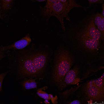 JunB (Phospho-Ser79) Antibody