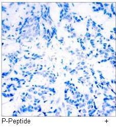 JunD (Phospho-Ser255) Antibody