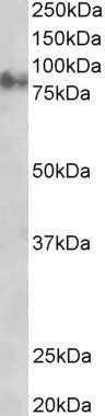 Goat anti-Plakoglobin / Gamma-catenin Antibody