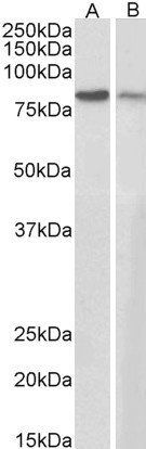 Goat anti-Plakoglobin / Gamma-catenin Antibody