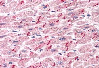 Goat anti-Plakoglobin / Gamma-catenin Antibody