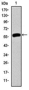JUP Antibody