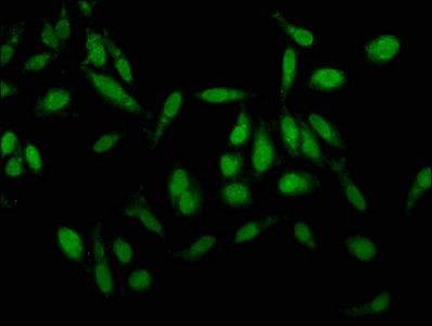 KLK1 Antibody