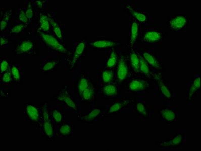 Kallikrein-1 antibody