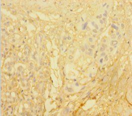KLK1 Antibody
