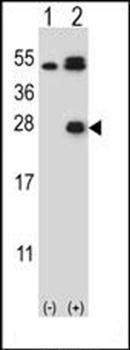 Kallikrein 6 antibody