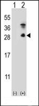 Kallikrein 7 antibody