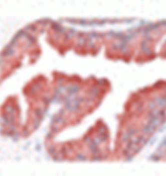 Kallikrein 2 Monoclonal Antibody