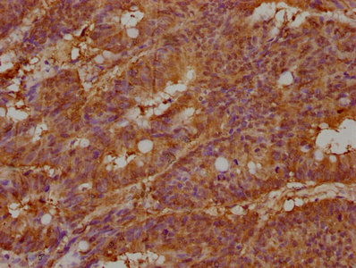 KALRN Antibody