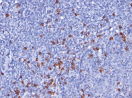 Mouse anti Human Kappa Light Chain Antibody