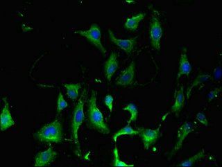 KARS antibody