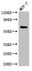 KARS antibody